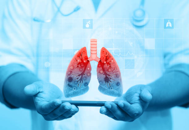 Exploring the Specialized Care: How Pulmonologists Diagnose and Treat Lung Conditions post thumbnail image